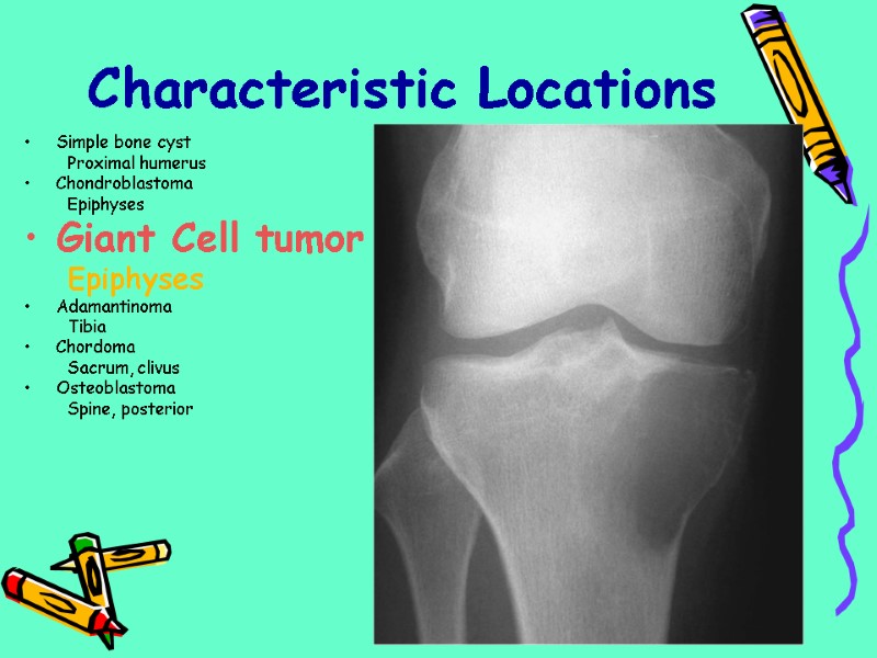 Simple bone cyst Proximal humerus Chondroblastoma Epiphyses Giant Cell tumor Epiphyses Adamantinoma Tibia Chordoma